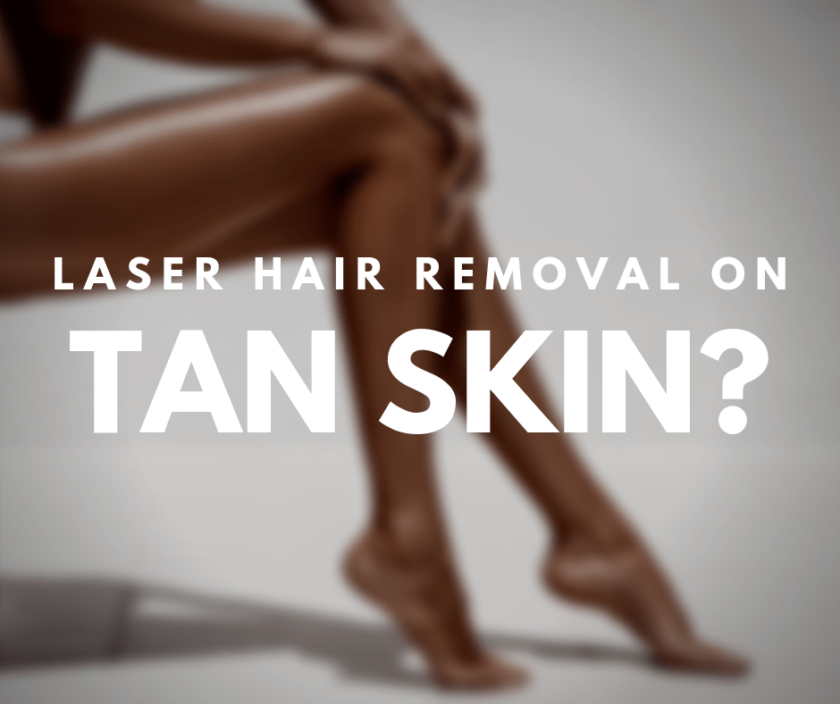 Laser Hair Removal Does it Work on Tan Skin?